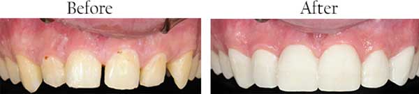 dental images 10461