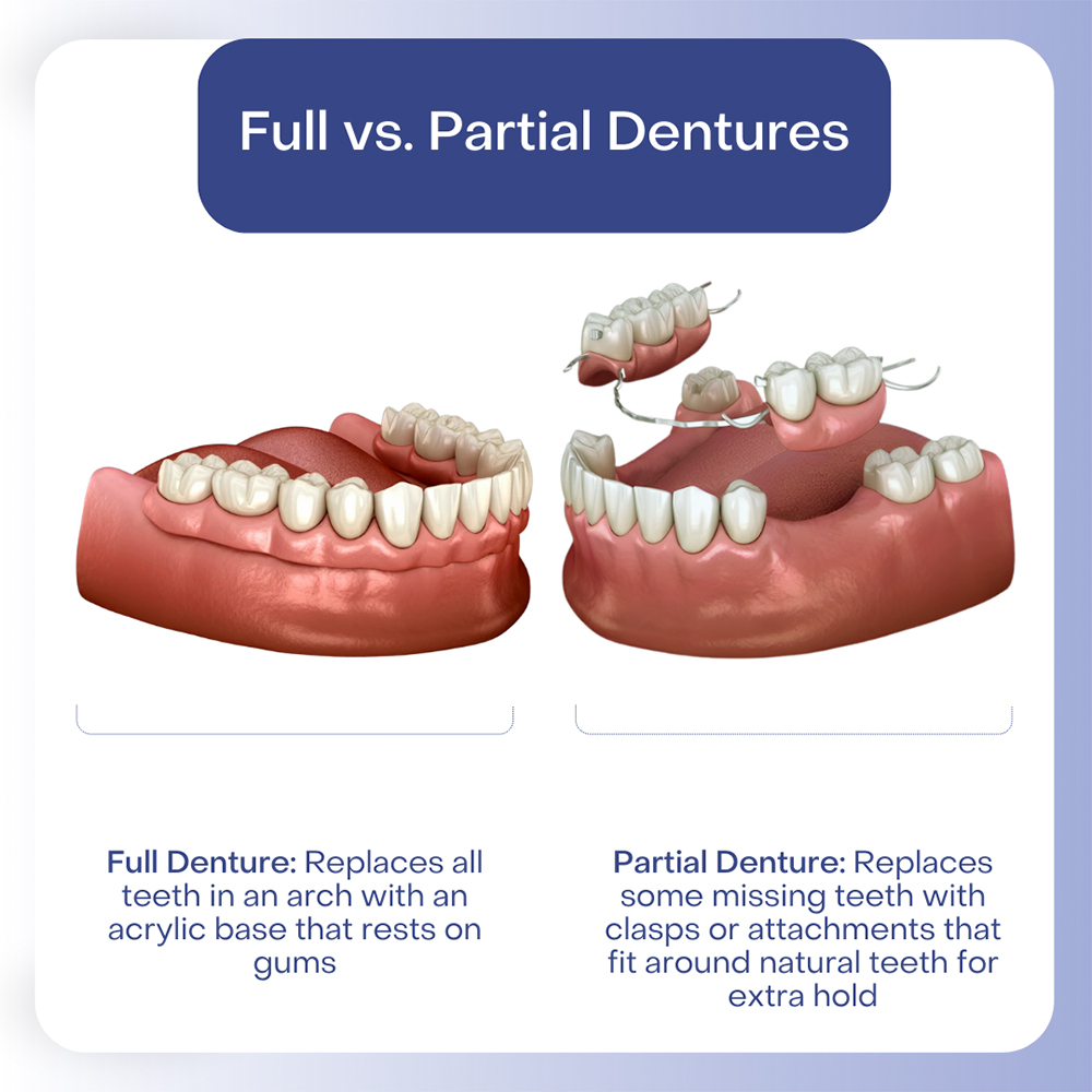 Full vs Partial Dentures