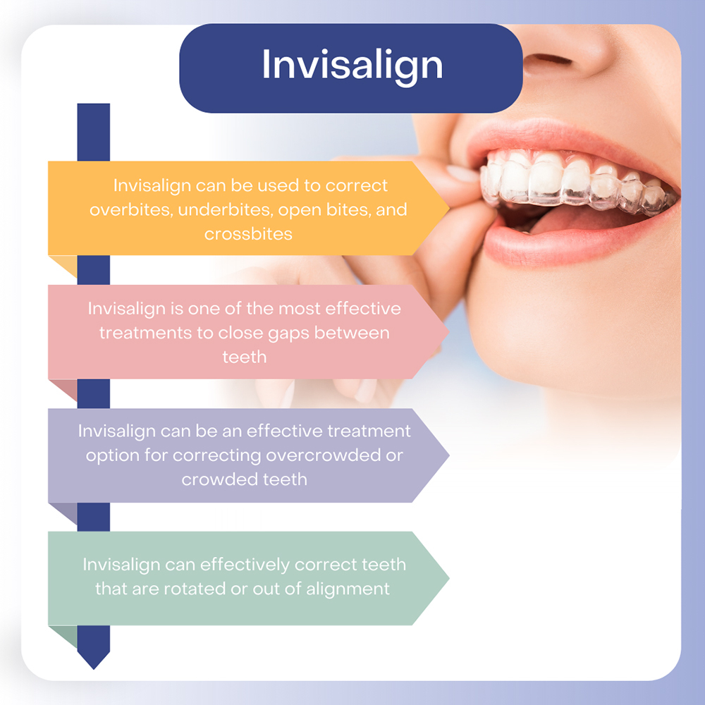 Invisalign Treatment