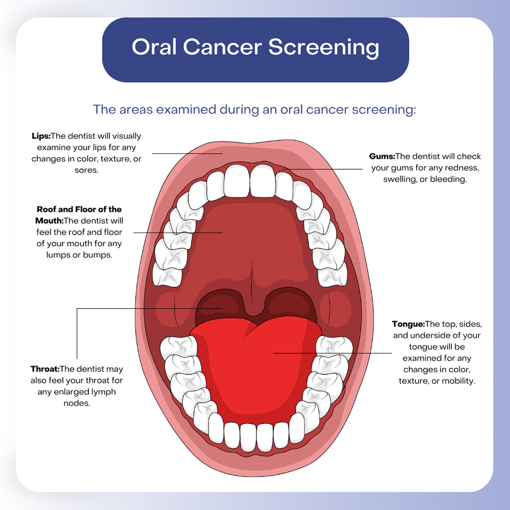 Oral Cancer Screening