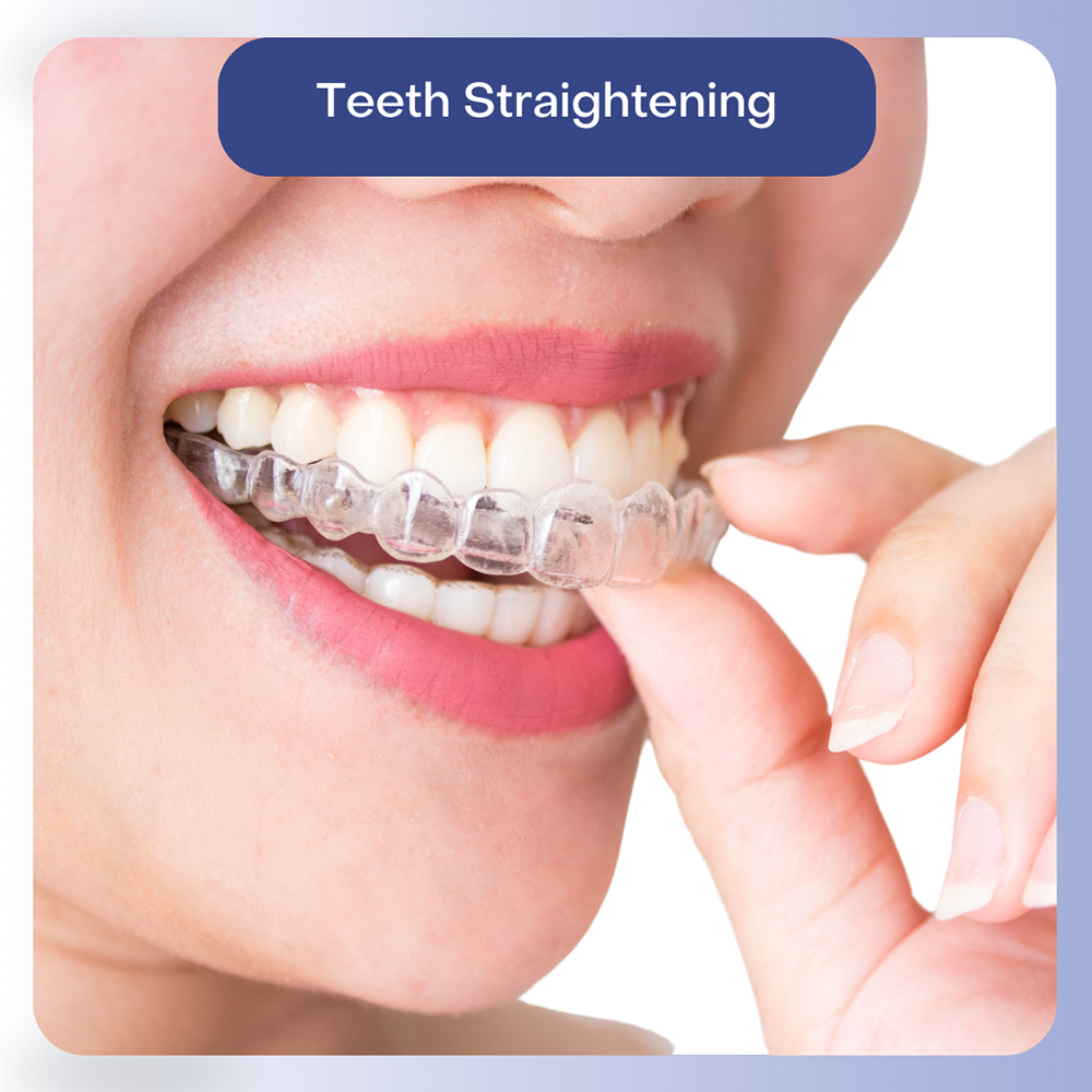 Teeth Straightening