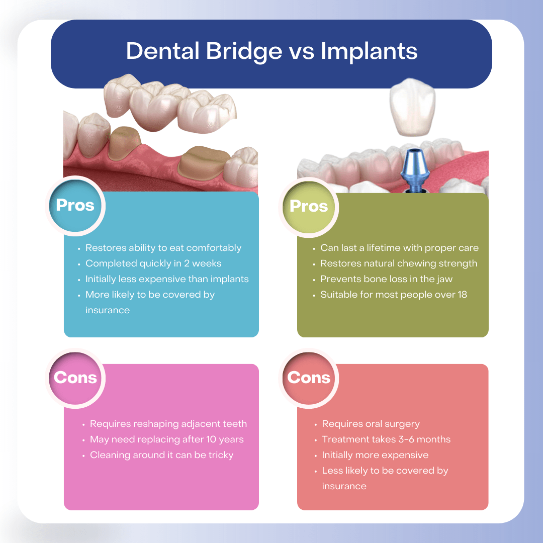 Dental Bridge vs Implants